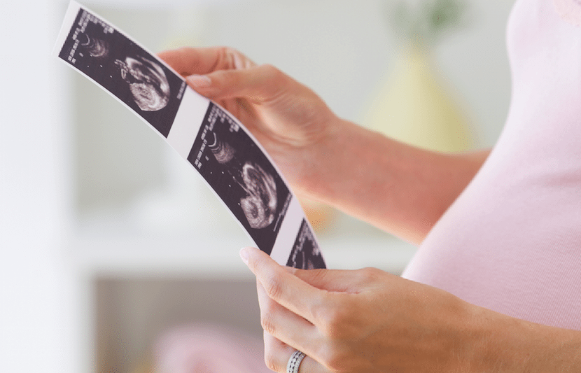 ¿Para qué sirve un ultrasonido en el embarazo?
