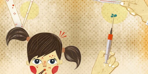Guía rápida para saber qué hacer si tu hijo tiene varicela