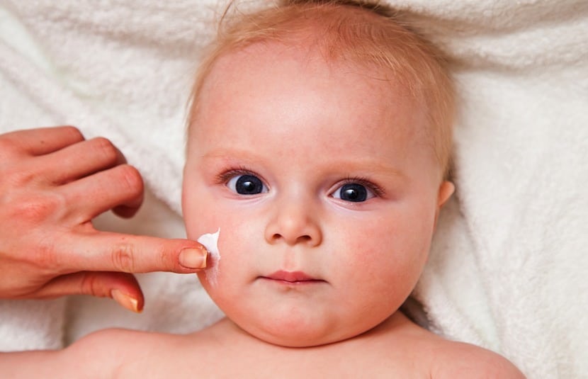 La dermatitis atópica en bebés y niños