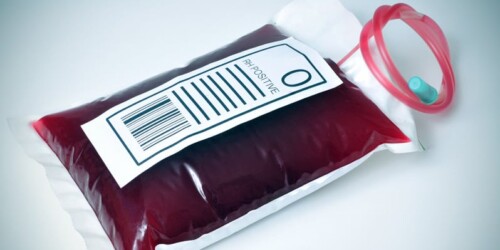Leucemia: qué es y cómo diagnosticarla a tiempo