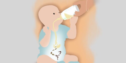 ¿Qué dice la popó de un bebé de su salud?