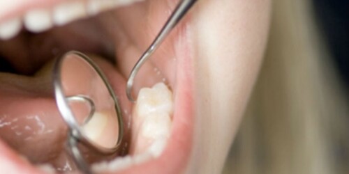 Lo que no sabías de los dientes de leche