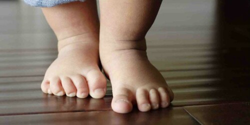Mitos del pie plano en niños