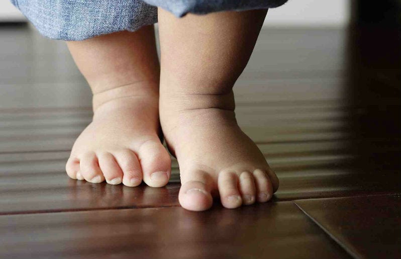Mitos del pie plano en niños