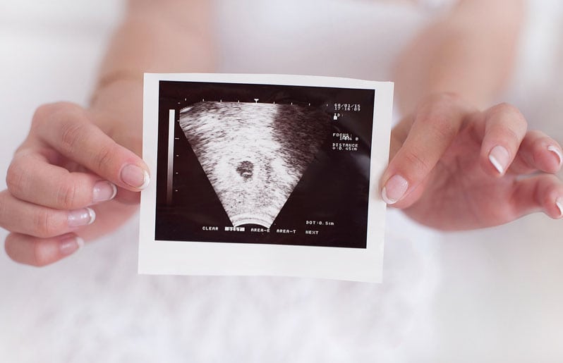 celulas madre de un bebe