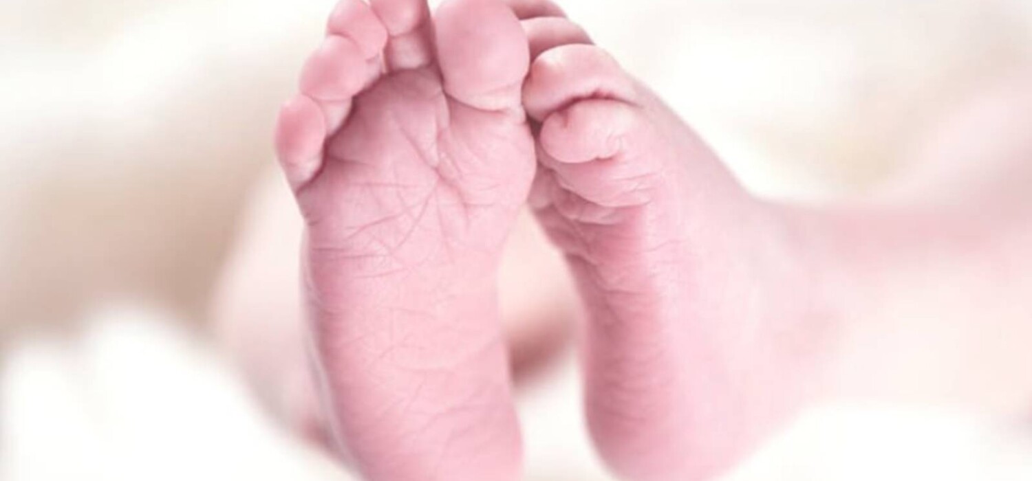 deformidades en los pies de los bebes