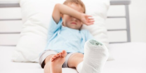 ¿Qué hacer si se fractura un hueso?