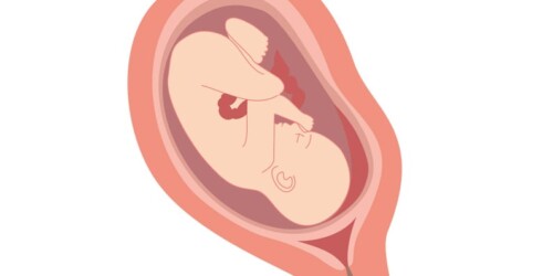 ¿Qué es la placenta previa?