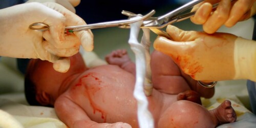 ¿Qué es una circular umbilical?