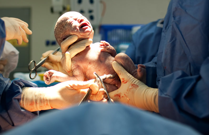 lesiones-del-bebe-durante-el-parto