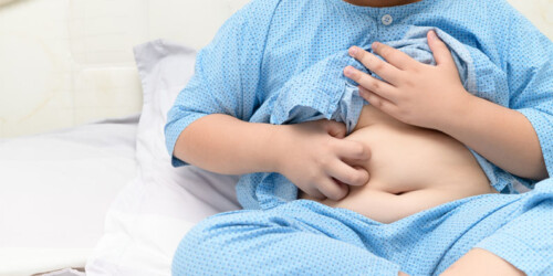 Cirugía infantil contra la obesidad: pros y contras