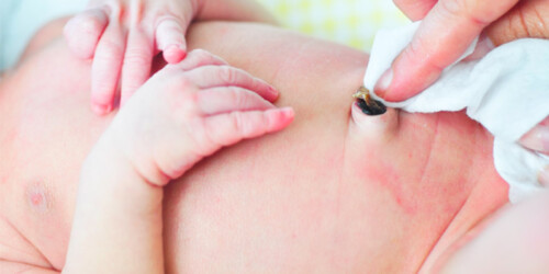 ¿Cómo cuidar el cordón umbilical del recién nacido?