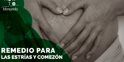 Remedio casero para las estrías en el embarazo