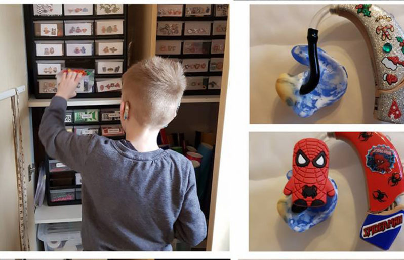Implantes cocleares con forma de superhéroes para niños