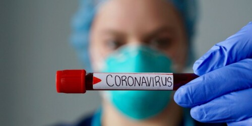 ¿Cómo evitar el contagio de Coronavirus?