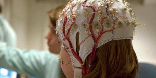 Epilepsia: causas, tratamientos y lo que debes saber