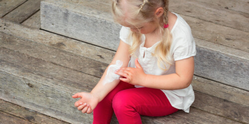 ¿Tú o tu bebé tiene dermatitis atópica?
