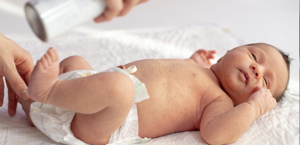 ¿Cómo tratar las irritaciones de los recién nacidos?