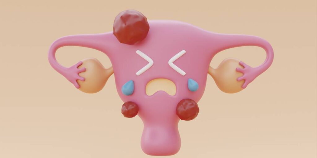 ¿Qué es el prolapso uterino o «matriz caída»?
