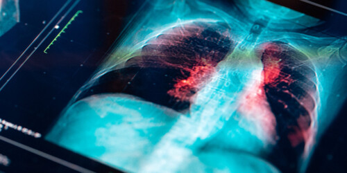 5 consejos para reforzar los pulmones de tus hijos