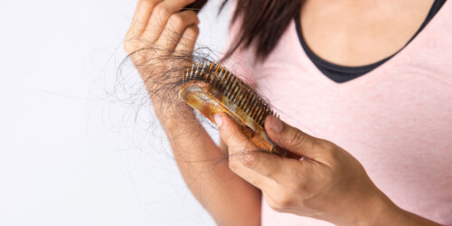 ¿Por qué se cae el pelo después de tener Covid-19?