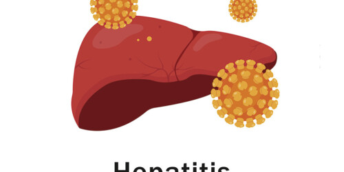 OMS confirma 169 niños contagiados de extraño brote de hepatitis aguda