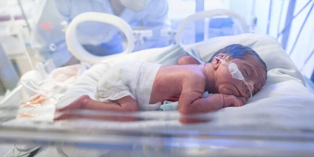 Diferencias de desarrollo y edad en los bebés prematuros