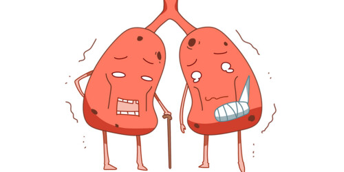 #DíadelPulmón: Controlar el asma es la clave para mantener la capacidad de los pulmones