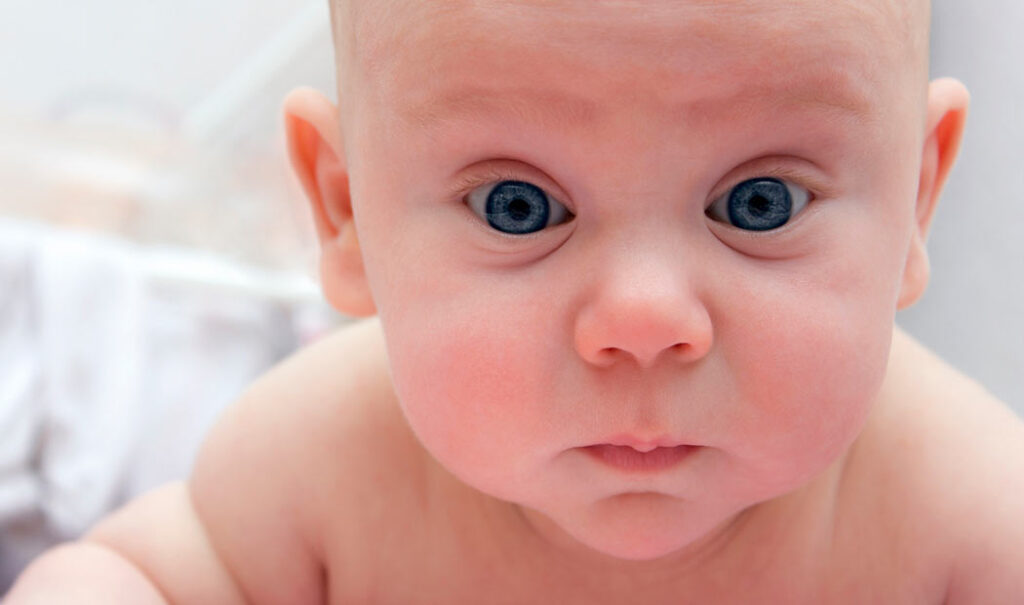 ¿Qué es la enfermedad del “niño bonito”?