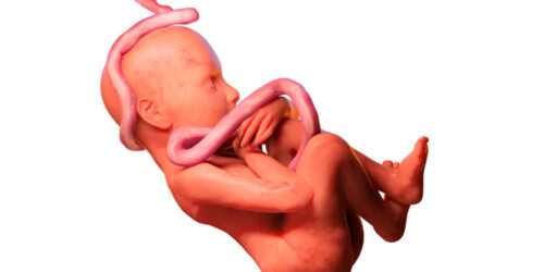 5 problemas que pueden suceder con el cordón umbilical