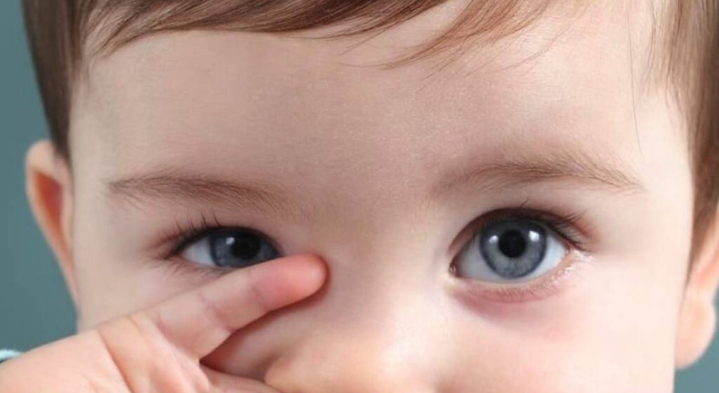 examen de la vista para niños y bebes