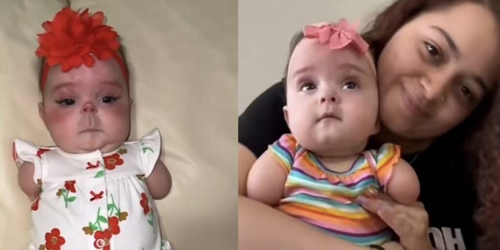 bebe que nacio sin piernas y brazos