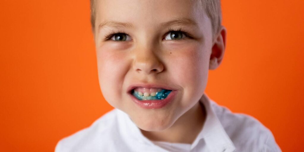 Expansor de paladar ¿realmente son una solución para los dientes de los niños?