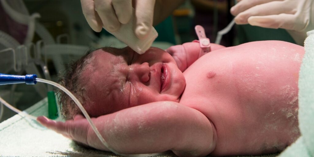 Casos en los que es necesaria la incubadora para bebés