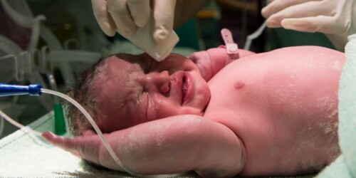 Casos en los que es necesaria la incubadora para bebés