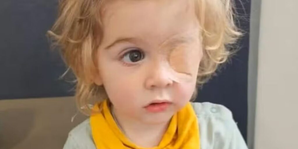 ¡Cuidado con los besos! Niño pierde la vista por infección de herpes