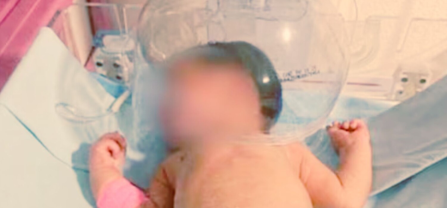 Bebé atendido con botella de plástico en hospital de Tabasco