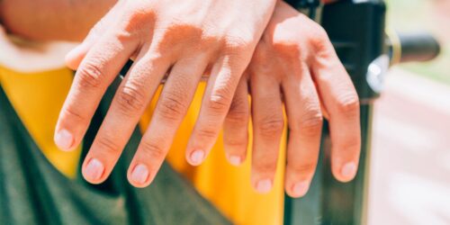 ¿Uñas color salmón? Saca consulta con el dermatólogo