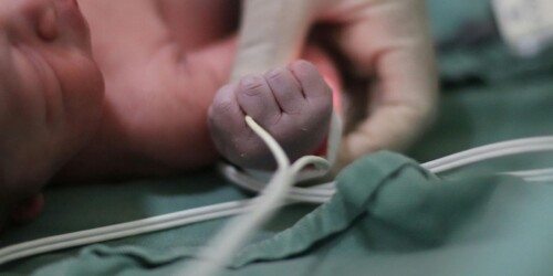 ¿Qué es la muerte cerebral en bebés? Guía clara para entenderlo